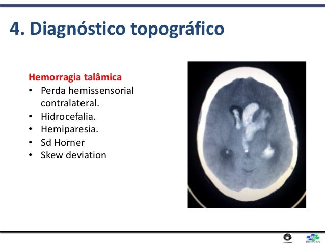 SCARICARE TALAMICA